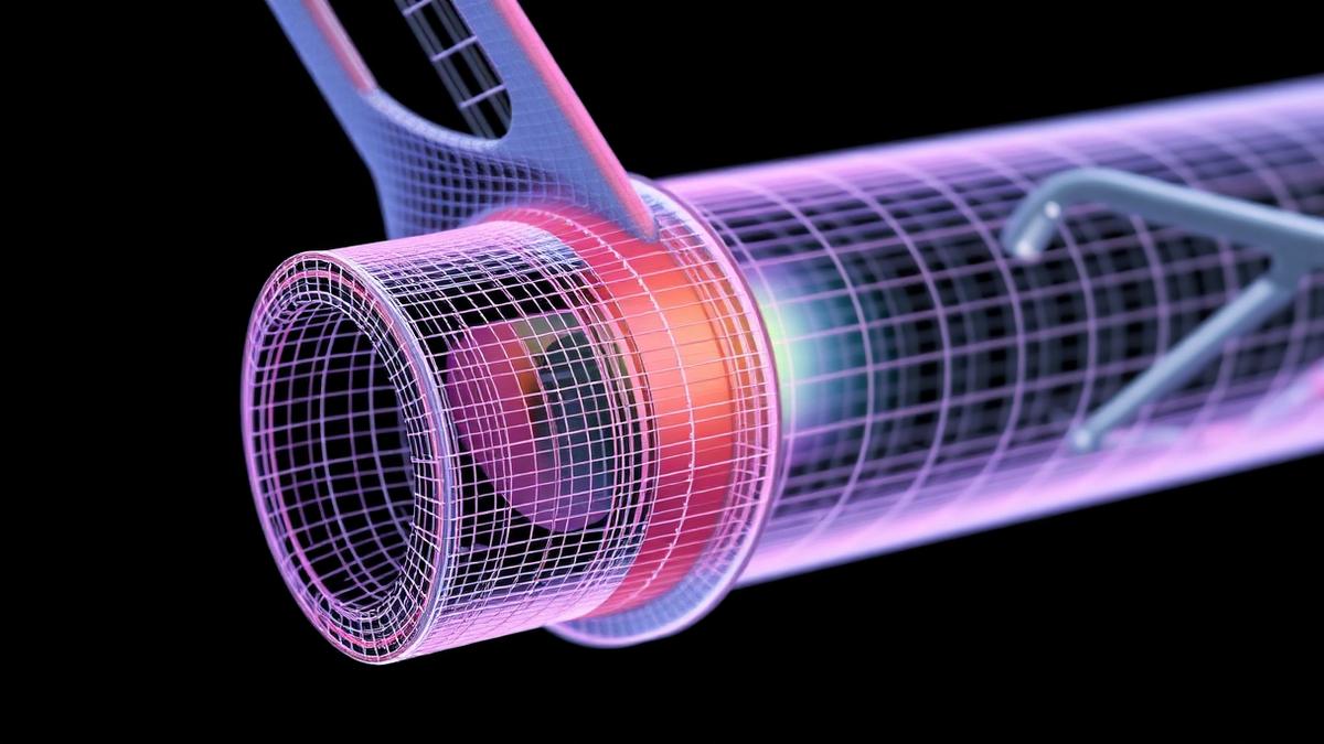 Finite element mesh on a structural component with stress gradient colours
